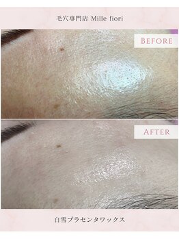 ミルフィオリ(Mille fiori)/白雪プラセンタワックス