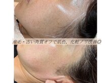 コモレビ(komorebi)