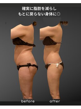 ナチュラル ビューティー スタイル さらさ(Natural Beauty Style)/リバウンドしない身体を目指す