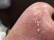 ミーミー 名古屋泉店(MeMe.)