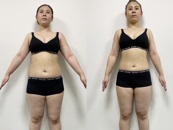 ネクストジムトウキョウ 目黒店(NEXT GYM TOKYO)/【ブライダルダイエット】