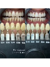 トウキョウスワーズ 池袋店(TOKYO SWRS)/#ホワイトニング #池袋 #渋谷