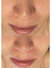 ビーメイクス(B・Makes)/ララピール