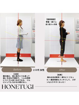 ほねつぎ総社 はりきゅう接骨院/成果/腰痛・肩こり・ダイエット