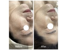 ダリア(Dahlia)/プラピール