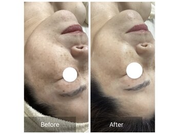 ダリア(Dahlia)/プラピール