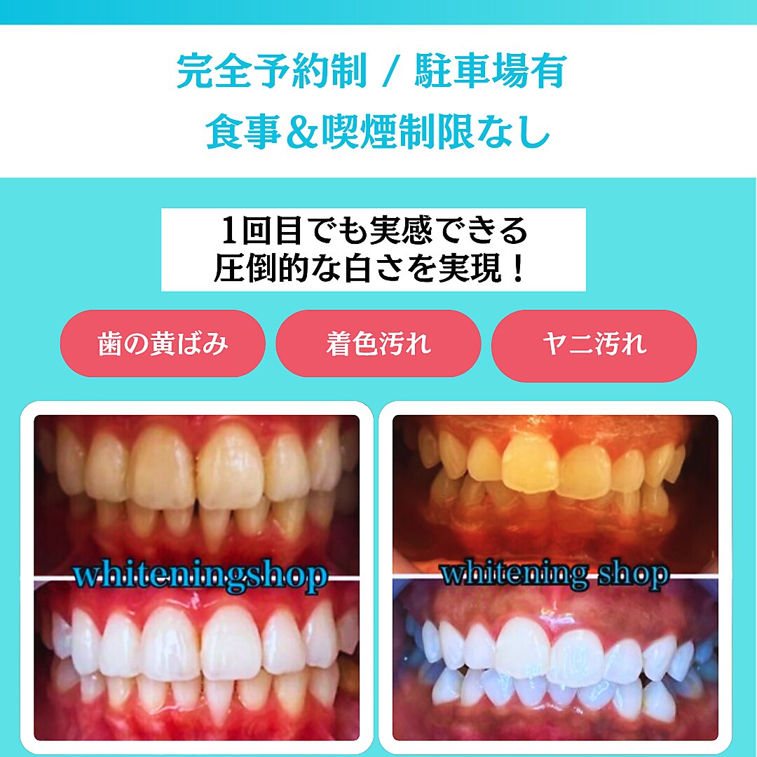 ホワイトニングショップ 栃木佐野店｜ホットペッパービューティー