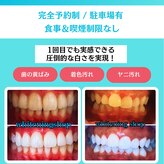 ホワイトニングショップ 栃木佐野店