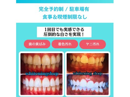 ホワイトニングショップ 栃木佐野店の写真
