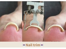 ネイルトリムは自然治癒力を引き出し、健康な爪に導きます!