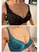 美人バスト 本厚木店/バストアップ◇症例◇