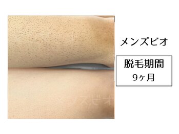 メンズビオ 神戸三宮店/