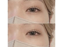 アノネ(anone)/マツパ上下