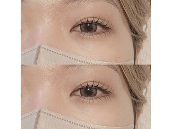 アノネ(anone)/マツパ上下