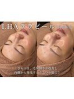 エムラボ 渋谷店(M LABO)/ララピール