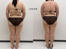 エルモサ 八王子の雰囲気（1回でも変化実感背中の厚み・セルライトケアで後ろ姿に変化実感）