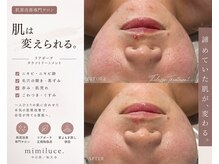 ミミルーチェ 中目黒(mimiluce)の雰囲気（《タラソハーブピーリング×若よもぎ蒸し》1回でこんなにツヤ肌）