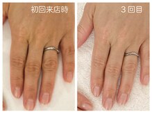 キレイテ 上野店/50代/3回目【ハンドケア上野】