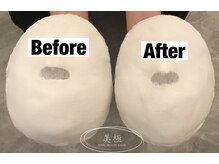 美極 トータルビューティー(美極 TOTAL BEAUTY)/恵比寿/小顔コルギ/エステ/