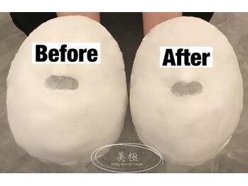 美極 トータルビューティー(美極 TOTAL BEAUTY)/恵比寿/小顔コルギ/エステ/