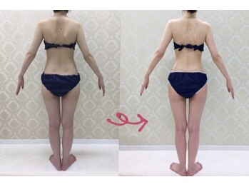 チャーム(Charm)/