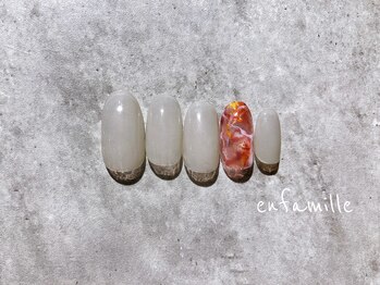 ハンド:定額Aコース