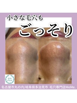 ミーミー 名古屋泉店(MeMe.)/