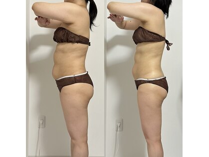 ミスティア(MISTIA)の写真