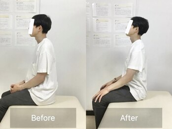 ナオル整体 国分寺院(NAORU整体)/30代男性【肩の違和感・姿勢】