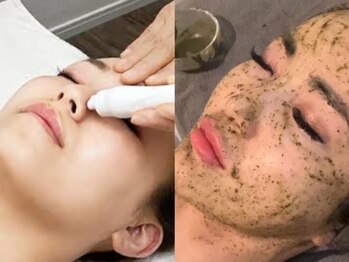 バタフライ 津田沼店(Butterfly)の写真/いちご鼻・黒ずみ・ニキビでお悩みの方必見！毛穴洗浄×ハーブピーリングで最強毛穴ケア！メンズも大歓迎◎