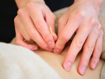 鍼灸院接骨院レジリエントボディ 武蔵中原店/鍼灸施術