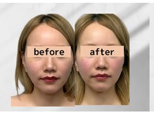 アールメディカルサロン 富山院(R Medical Salon)/理想のV字リフト