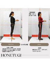 ほねつぎ総社 はりきゅう接骨院/成果/首肩こり・ダイエット