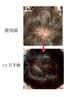 【お悩み別★少毛細毛増毛】ご要望ご予算で最適プランご提案¥8800～
