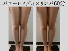 マーベル(MaaBelle)/パワーレメディ×リンパ60分