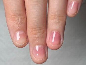 イッポ(ippo)の写真/【痛んだ爪、深爪、噛み爪でお悩みの方】お手元をきれいにしたい方は要必見！指先に自信を★