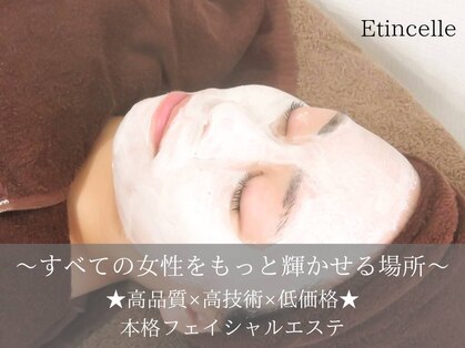 エステティックジュビラン エタンセル(Etincelle)の写真