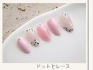 ドットとレース