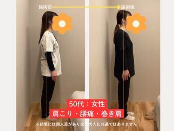 ソルム(solmu)/