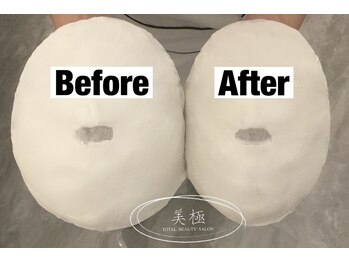 美極 トータルビューティー(美極 TOTAL BEAUTY)/恵比寿/小顔コルギ/エステ/