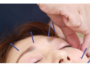 エムアンドエス鍼灸整骨院(M&S鍼灸整骨院)/美顔鍼