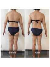 ボディメイクサロンアプローズ/ヒップアップと、小尻ケア