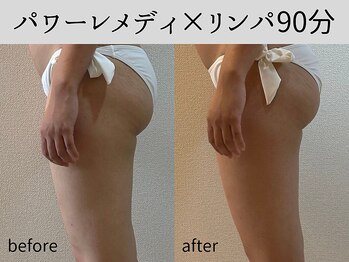 マーベル(MaaBelle)/パワーレメディ×リンパ90分