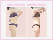 スリムライン 八戸店(The Slim Line)/before→after