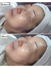 ソワナ(soina)/【神楽坂駅/フェイシャル/毛穴】