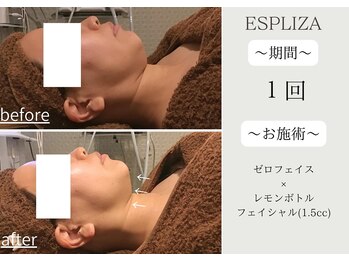 エスプライザ 横浜駅前店/韓国で大人気【レモンボトル】