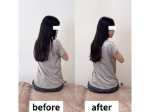ヘルシールーム 六本木7丁目店(Healthy room)/before/after【腰痛/反り腰】