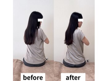 ヘルシールーム 六本木7丁目店(Healthy room)/before/after【腰痛/反り腰】