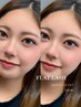 【高持続LED】FLATLASH100本