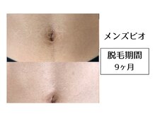 メンズビオ 神戸三宮店/